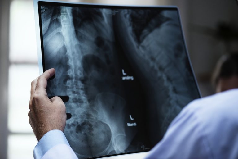 anatomy-3003099_960_720