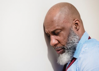 4 Things You Need To Know Before Getting A Hair Transplant