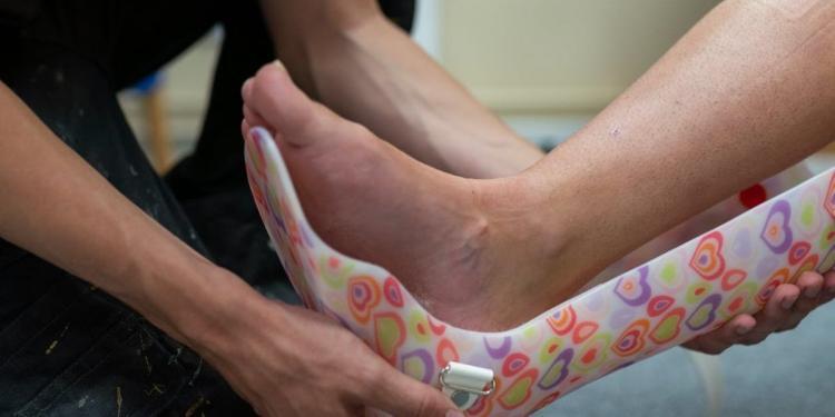 person putting ankle foot orthosis to the patient