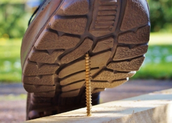 Smart Tips on Finding the Right Lawyer for Your Injury Case