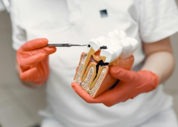 Close-up of dentist holding a tooth model, illustrating dental care concepts.