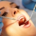 The Importance of Regular Dental Cleanings for Oral Health