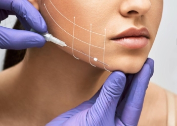Debunking Myths About Thread Lift