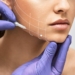 Debunking Myths About Thread Lift