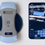How Handheld Ultrasound Is Expanding Access to Care in Smaller Communities