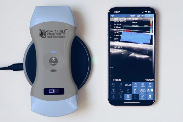6a7857b22ff7c_How Handheld Ultrasound Is Expanding Access to Care in Smaller Communities