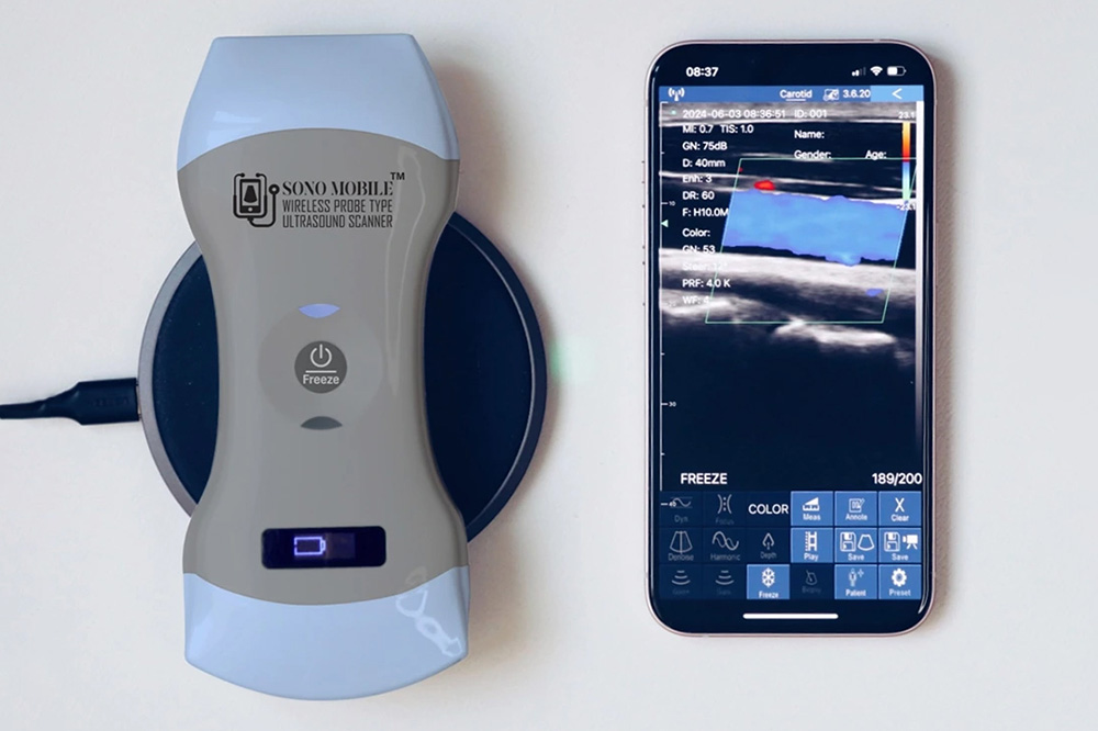 6a7857b22ff7c_How Handheld Ultrasound Is Expanding Access to Care in Smaller Communities
