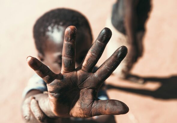 boy with black stain on hand